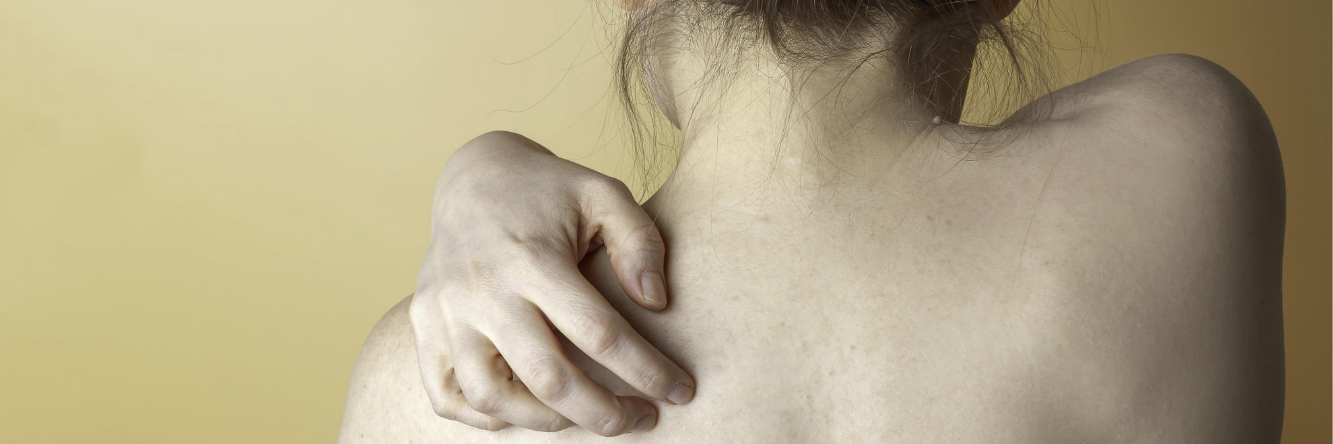 A woman with shoulder pain due to osteoarthritis.