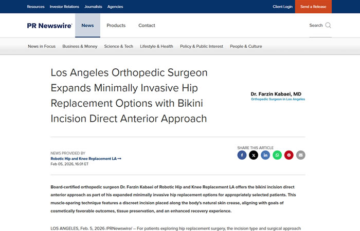 screenshot of the article titled : Los Angeles Orthopedic Surgeon Expands Minimally Invasive Hip Replacement Options with Bikini Incision Direct Anterior Approach
